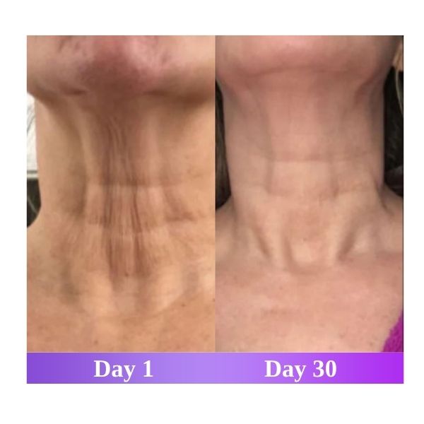 Solvye - LED Face & Neck Sculptor