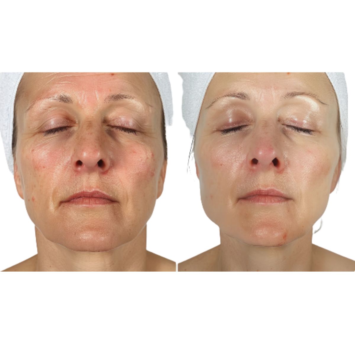 Solvye - Collagen Peel Off Night Mask