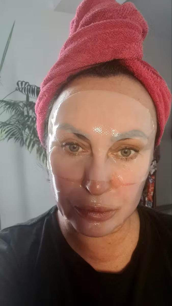 Sofia L., dry skin
